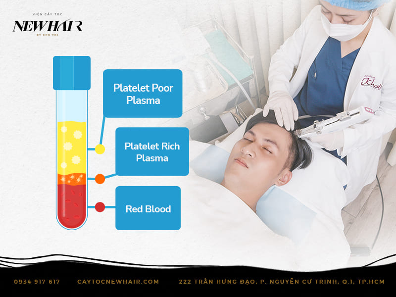 hair prp injection