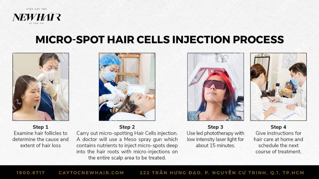 micro spot hair cells injection