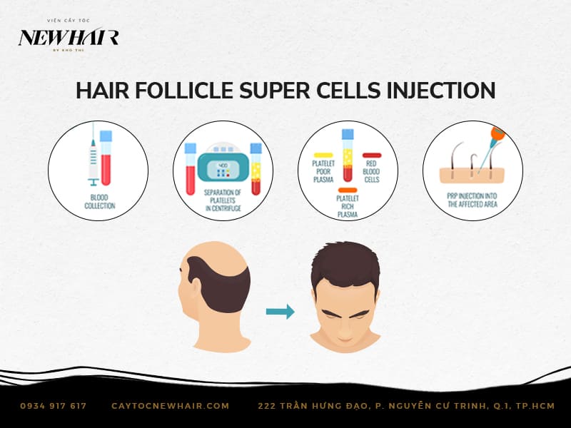 super cells injection newhair