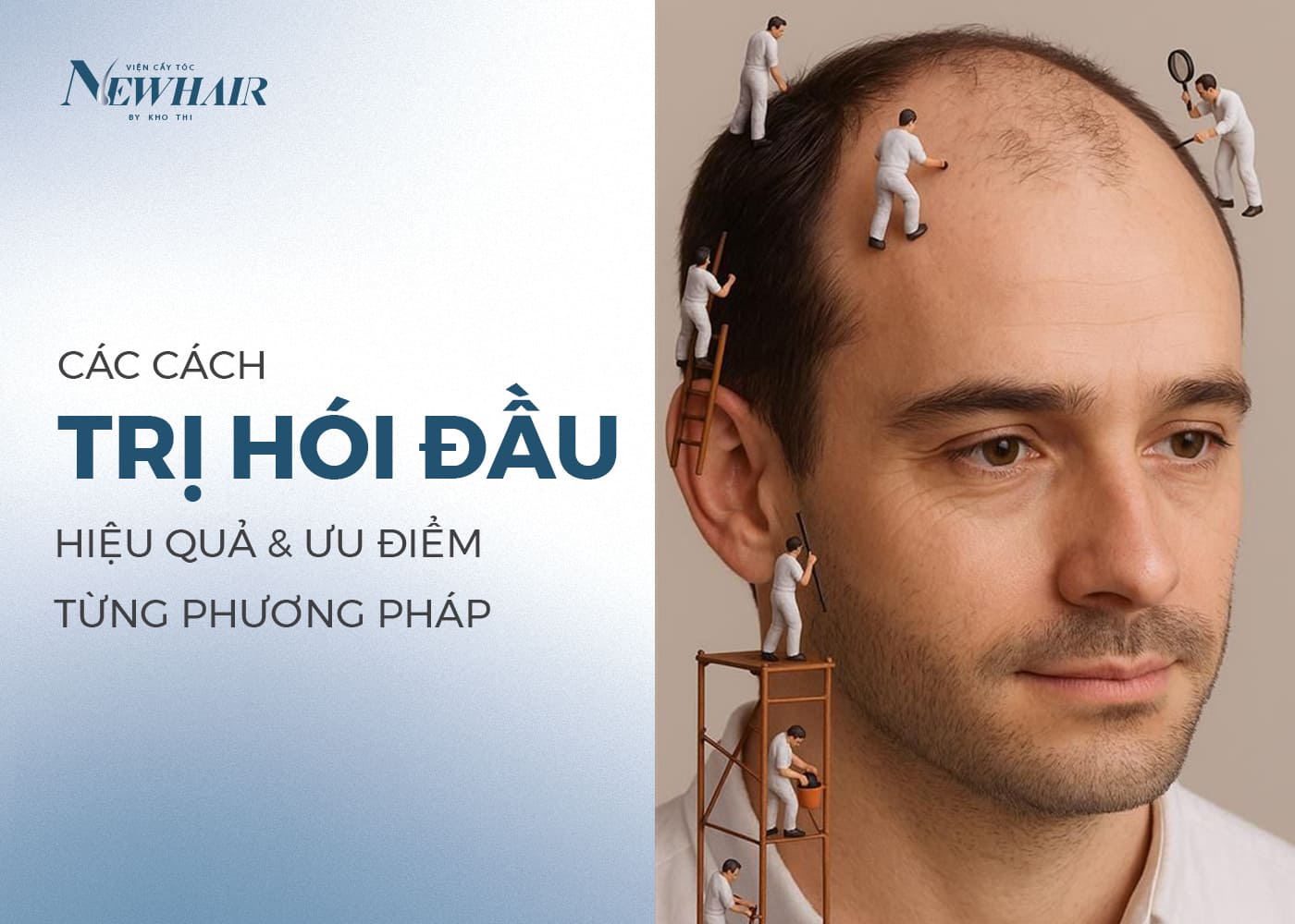 cách trị hói đầu