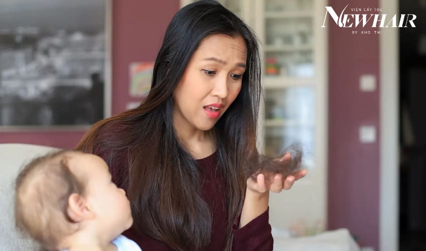 nguyên nhân rụng tóc sau sinh