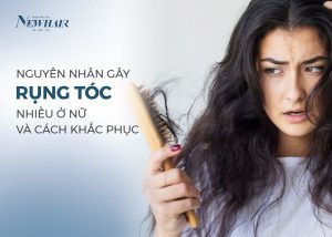 rụng tóc nhiều ở nữ