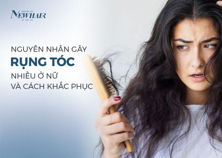 rụng tóc nhiều ở nữ