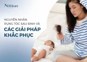rụng tóc sau sinh ở nữ