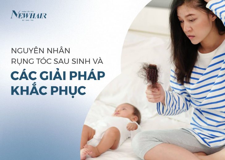 rụng tóc sau sinh ở nữ