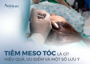 tiêm meso tóc là gì