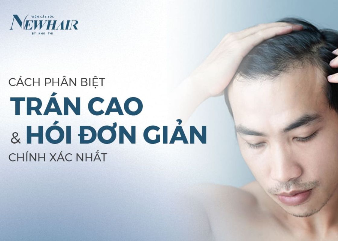 cách phân biệt trán cao và hói