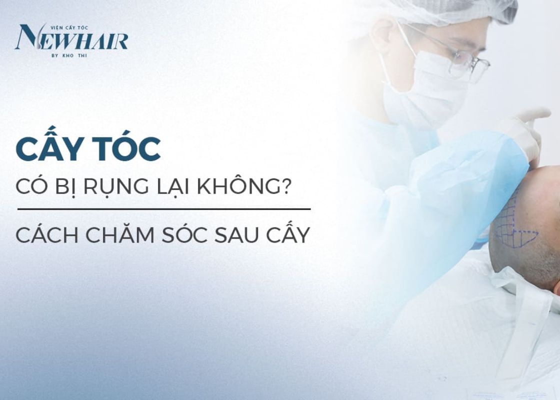 cấy tóc có bị rụng lại không