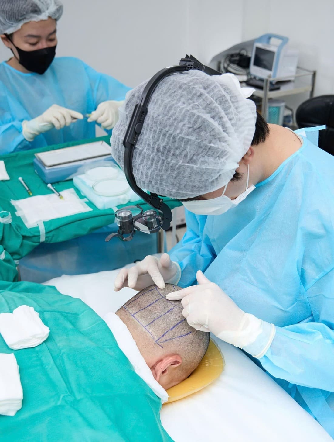 cấy tóc tự thân
