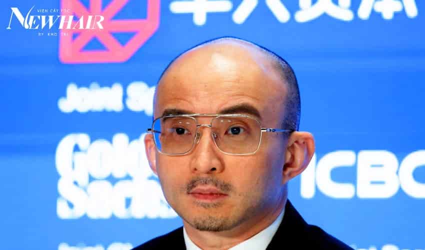 dấu hiệu hói hoàn toàn