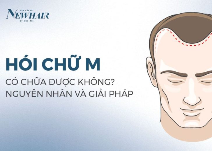 hói chữ m chữa được không