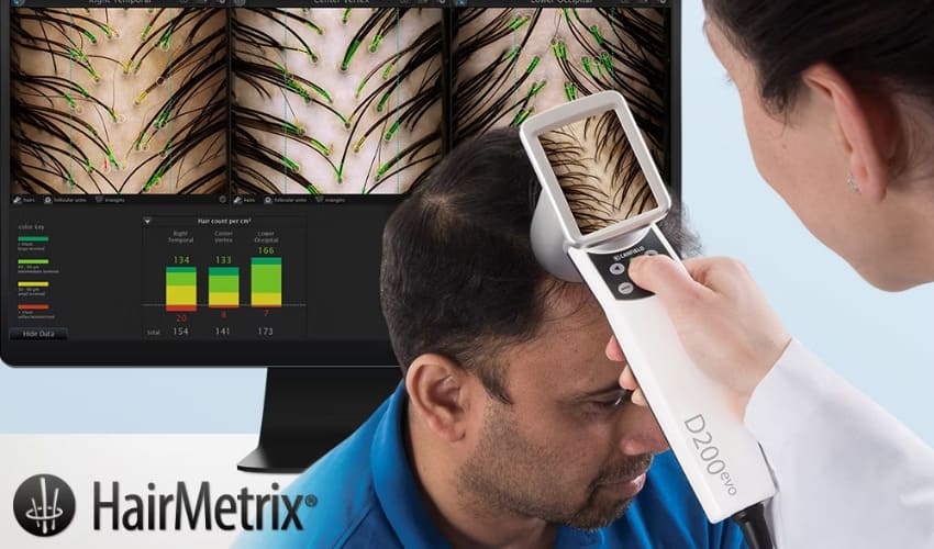 máy soi nang tóc Hairmetrix