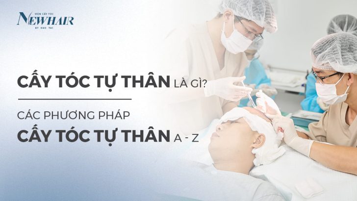 phương pháp cấy tóc tự thân