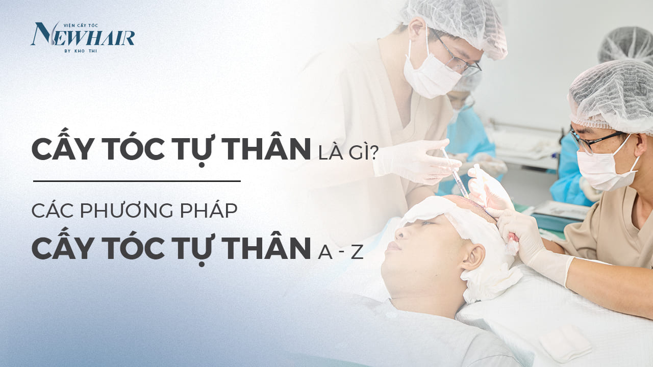 phương pháp cấy tóc tự thân