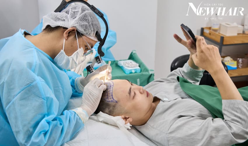 soi nang tóc trong cấy tóc newhair