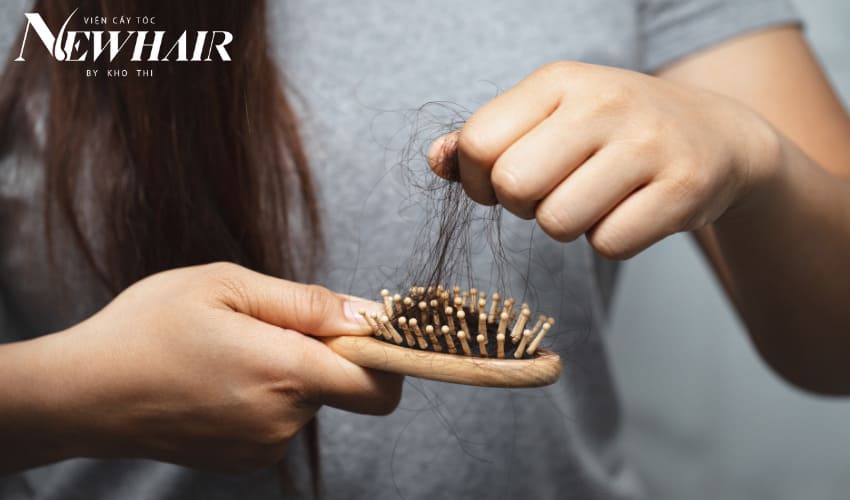 bị hói ở đỉnh đầu nữ