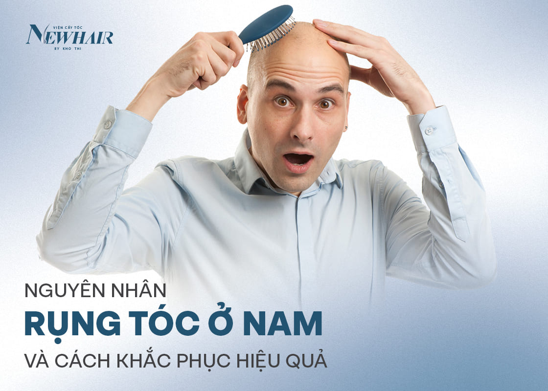 các nguyên nhân rụng tóc ở nam