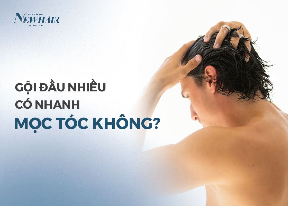 gội đầu nhiều nhanh mọc tóc đúng không