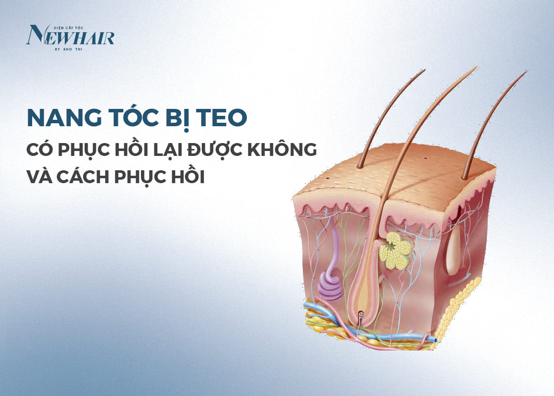 nang tóc bị teo có phục hồi được không