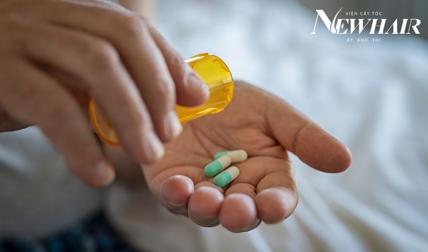 nguyên nhân rụng tóc ở nam