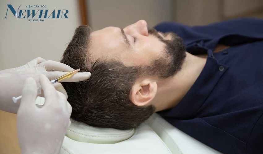 tóc rụng nhiều ở nam