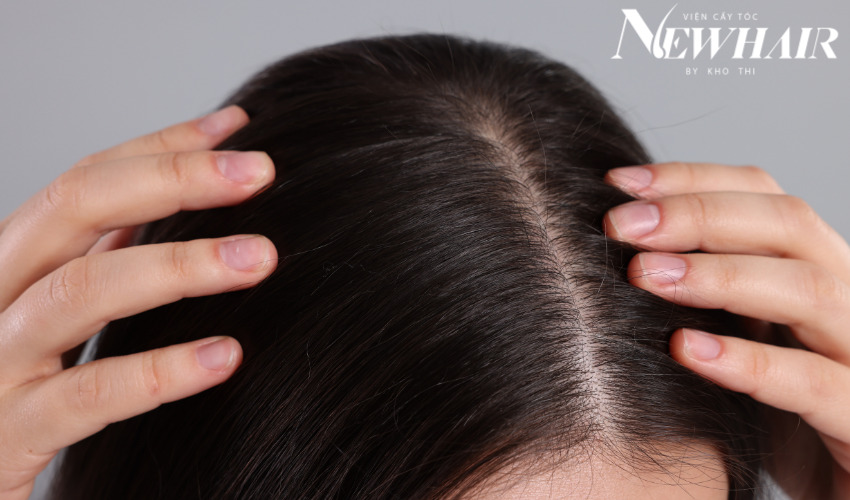 các loại da đầu