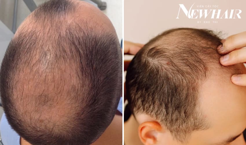 cấu trúc da đầu