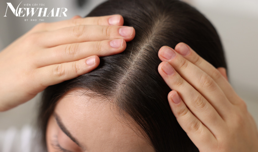 phân loại da đầu