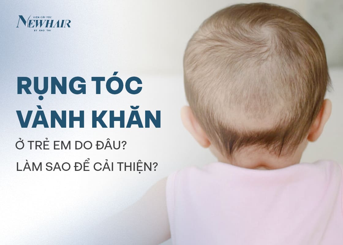 rụng tóc vành khăn là gì