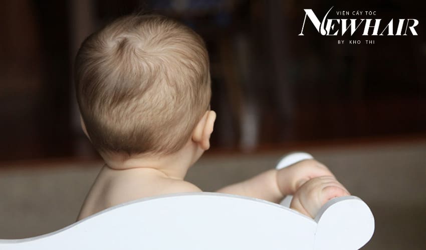 rụng tóc vành khăn