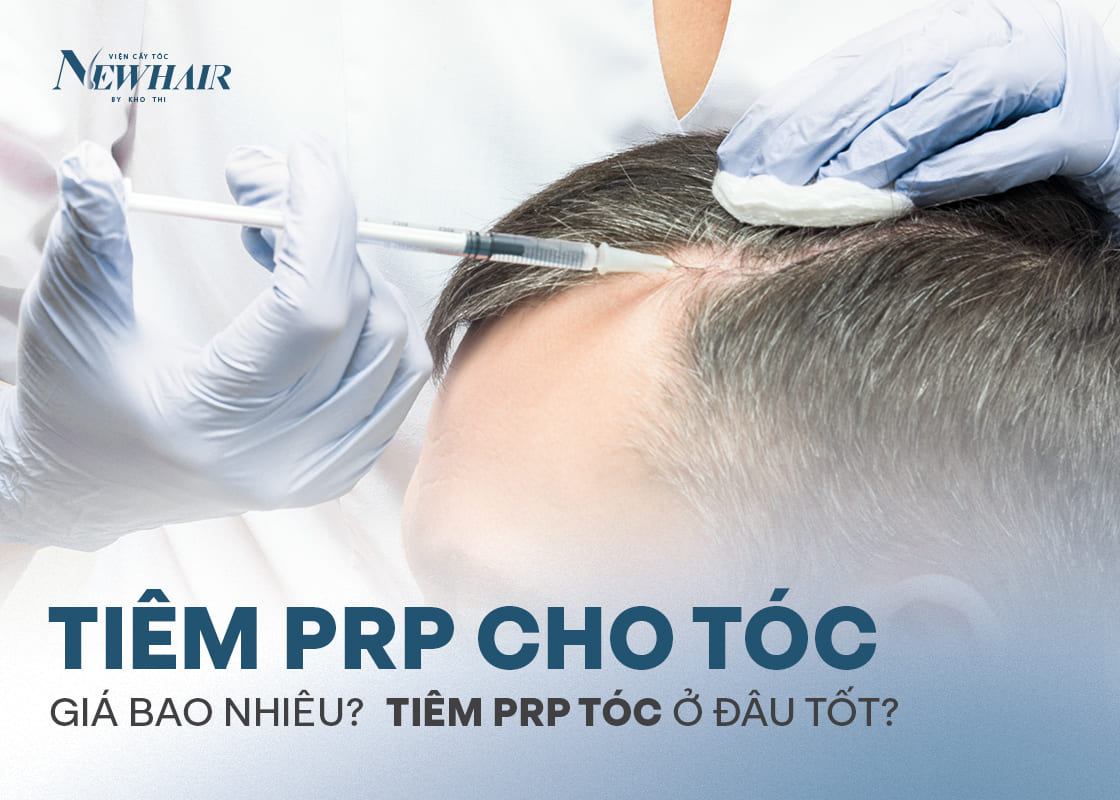 tiêm prp cho tóc giá bao nhiêu newhair
