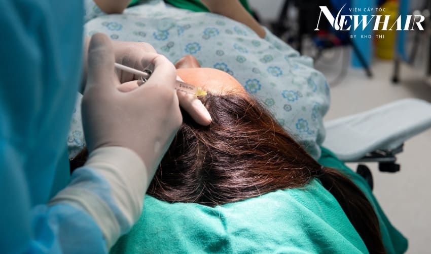 tiêm prp cho tóc giá bao nhiêu
