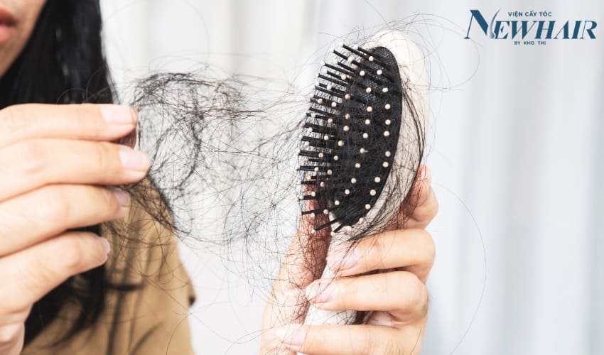 tóc rụng chân tóc có màu trắng