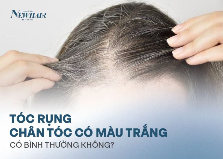 vì sao tóc rụng chân tóc có màu trắng