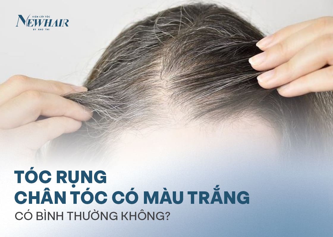 vì sao tóc rụng chân tóc có màu trắng
