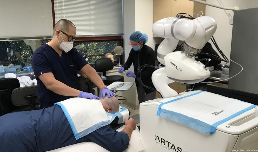 cấy tóc bằng robot artas