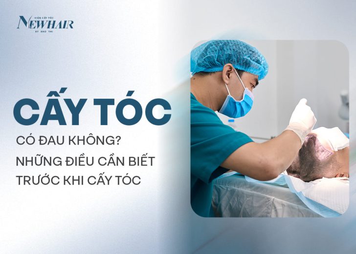 cấy tóc có đau không