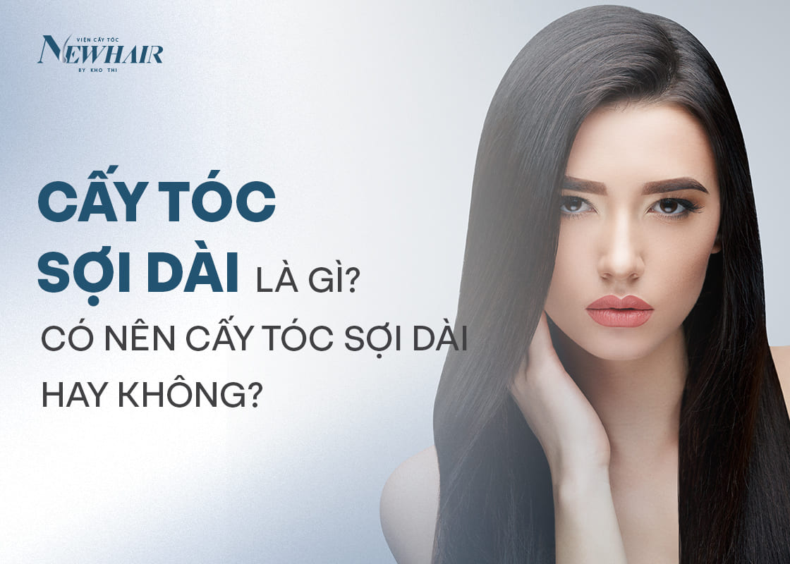 cấy tóc sợi dài