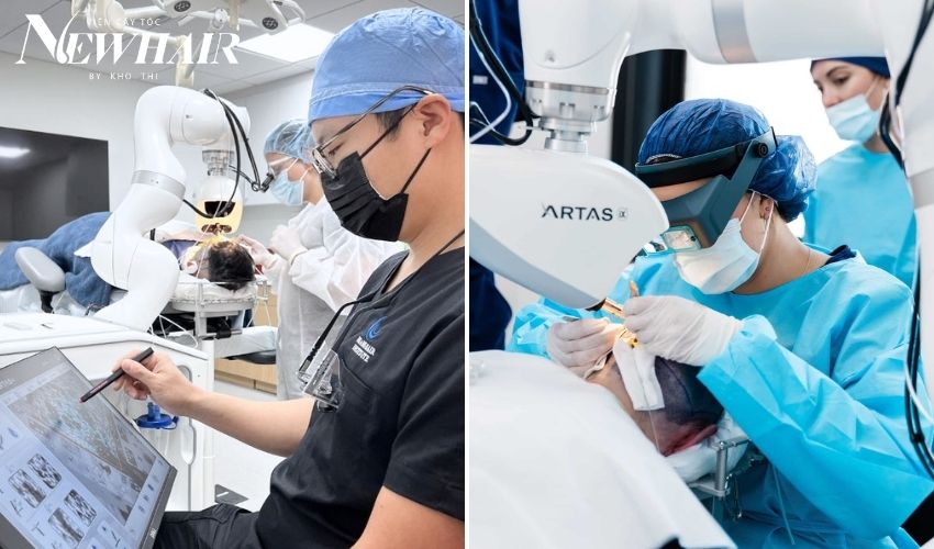 cấy tóc thẩm mỹ bằng robot