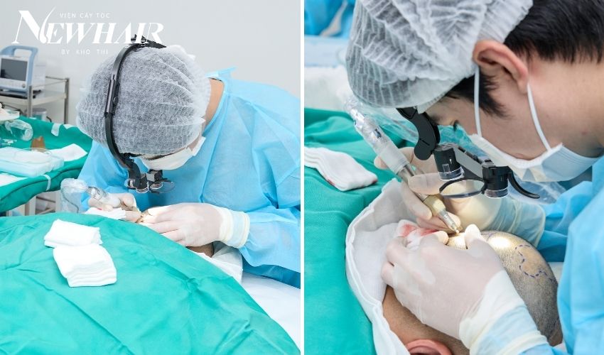 gây tê cấy tóc tự thân