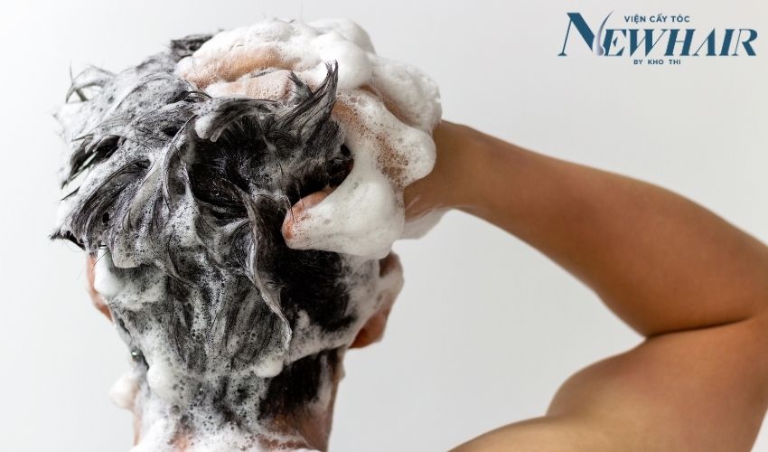 làm gì khi bị hói đầu khi còn trẻ