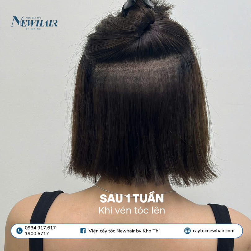 sau 1 tuần khi vén tóc