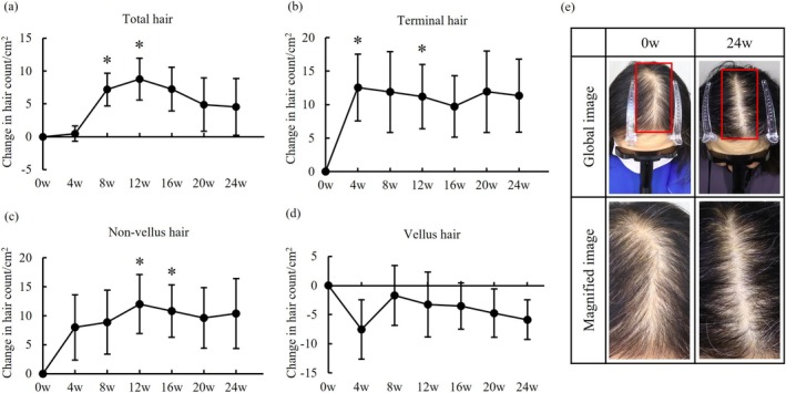 kết quả thử nghiệm minodixil 5%