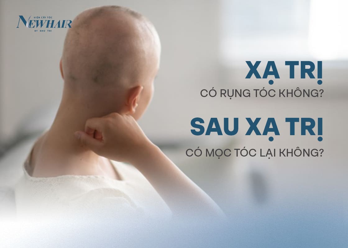 xạ trị có rụng tóc không