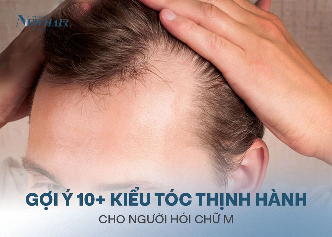 kiểu tóc cho người hói chữ m