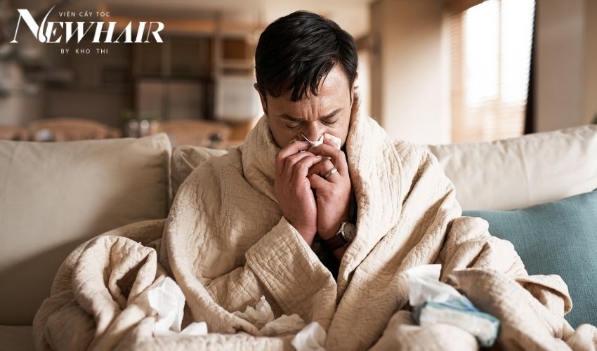 nguyên nhân nấm da đầu rụng tóc