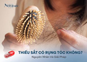 thiếu sắt có gây rụng tóc không