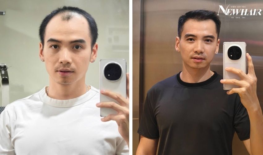 nhiếp ảnh gia tuấn khôi