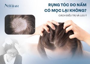 rụng tóc do nấm có mọc không