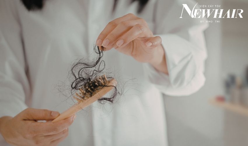 rụng tóc nhiều là bệnh gì